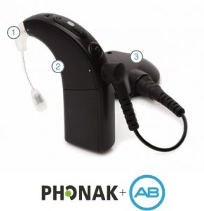 Advanced Bionics cochleáris implantátum Naída hangprocesszor