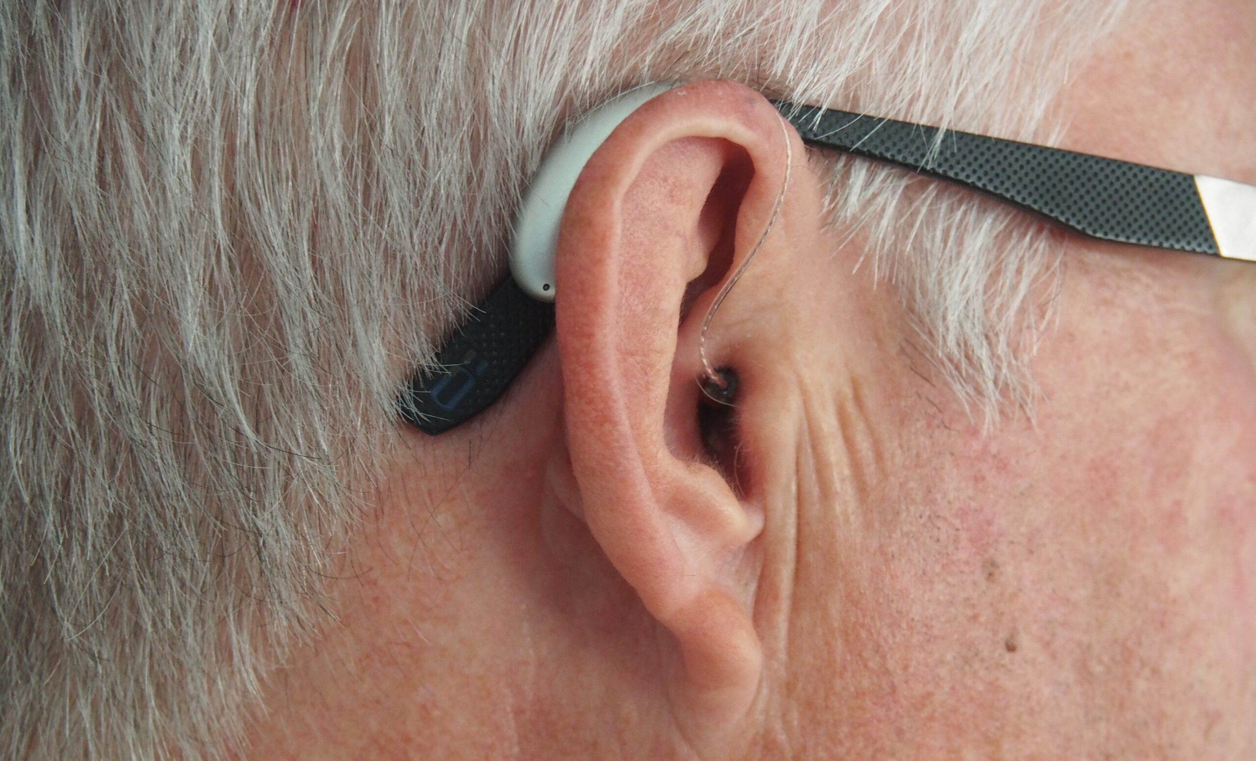 Tökéletes tervezés és teljesítmény:<br> Qscreen hordozható, objektív hallásszűrő berendezés